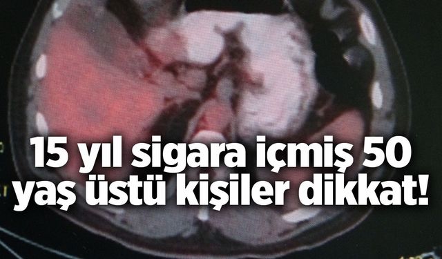 Uzmanından akciğer kanseri uyarısı... 15 yıl sigara içen 50 yaşındakilere uyarı