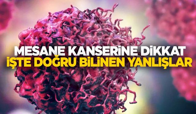 Mesane kanseri hakkında doğru bilinen yanlışlar