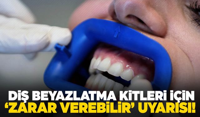 Diş beyazlatma kitleri için uyarı: “Zarar verebilir”