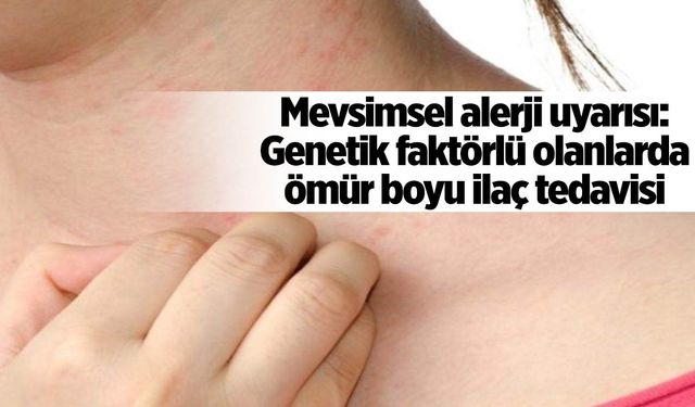 Mevsimsel alerji uyarısı: Genetik faktörlü olanlarda ömür boyu ilaç tedavisi