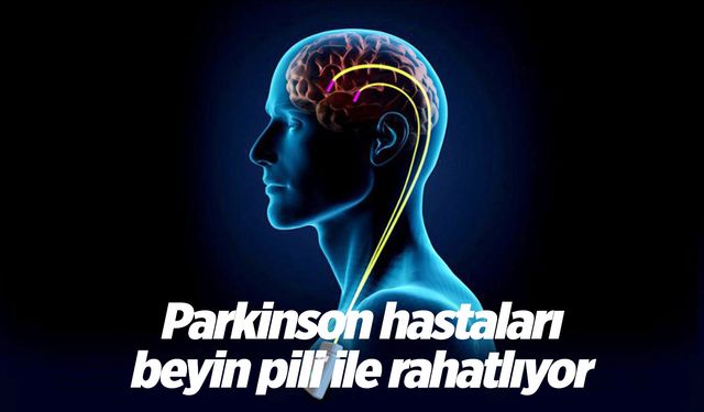 Parkinson hastalarında beyin pili hayatı kolaylaştırıyor
