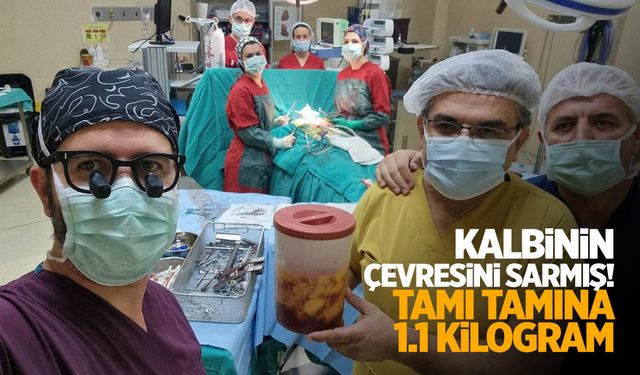 Doktorlar bile şaşırdı! Kalbin çevresini sarmış... Tam 1.1 kilogram!