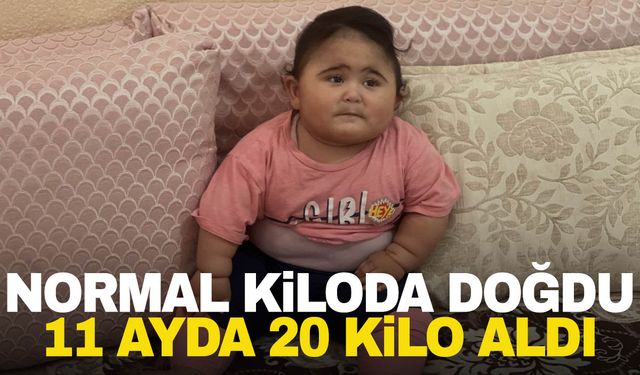 Hızla kilo alıyor! Normal kiloda doğan bebek 11 ayda 20 kiloyu geçti