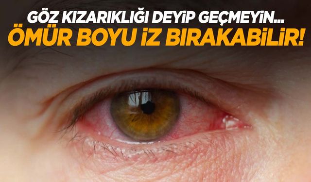 Aman dikkat! Bu hastalık gözde ömür boyu iz bırakabiliyor!