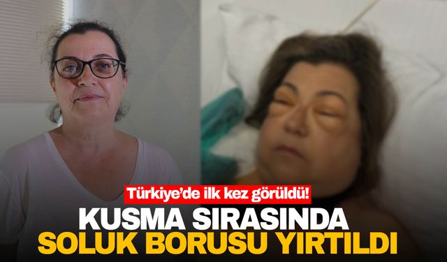 Türkiye’de ilk kez görülen bir vaka! Kusma sırasında soluk borusu yırtıldı…