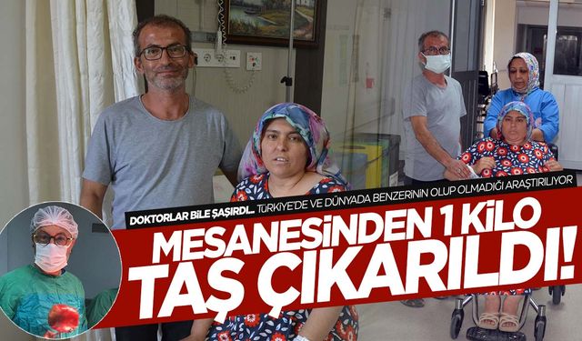 Kırkağaç'ta ağrı şikayetiyle gittiği hastanede şok oldu! Mesanesinden 1 kilo taş çıktı!