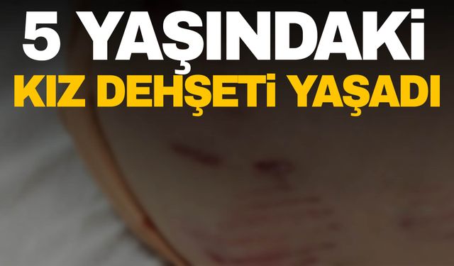 Başkentte başıboş sokak köpekleri dehşet saçtı! 5 yaşındaki kıza saldırdılar