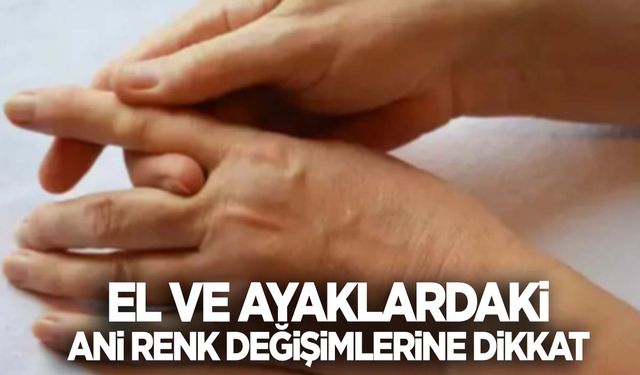 En sık genç kadınlarda ortaya çıkıyor… El ve ayaklardaki ani renk değişimlerine dikkat!