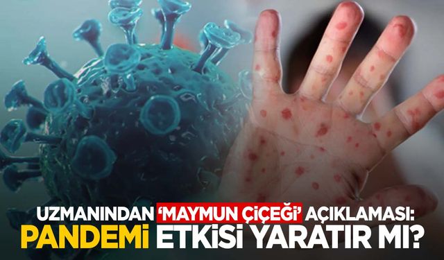 Maymun çiçeği pandemiye dönüşür mü? Manisa’dan açıklama geldi!