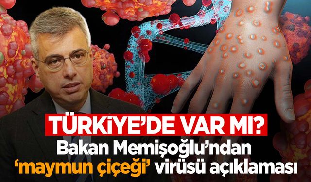 Türkiye’de maymun çiçeği virüsü var mı? Bakan Memişoğlu’ndan flaş açıklama