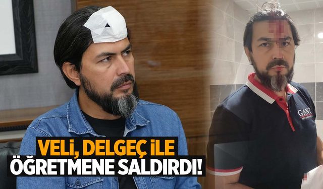 Kastamonu’da öğretmene delgeçli saldırı! Başına 5 dikiş atıldı!