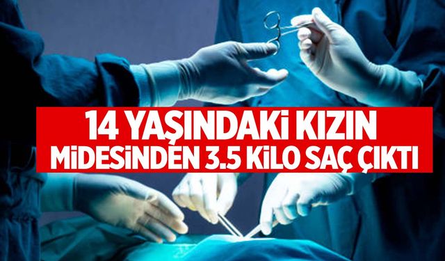 Kayseri’de 14 yaşındaki kızın midesinden tam 3.5 kilo saç çıktı!