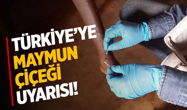 Türkiye’ye Maymun Çiçeği Uyarısı!