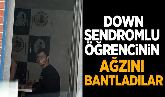 Böyle vicdansızlık görülmedi! Down sendromlu öğrencinin ağzını bantladılar