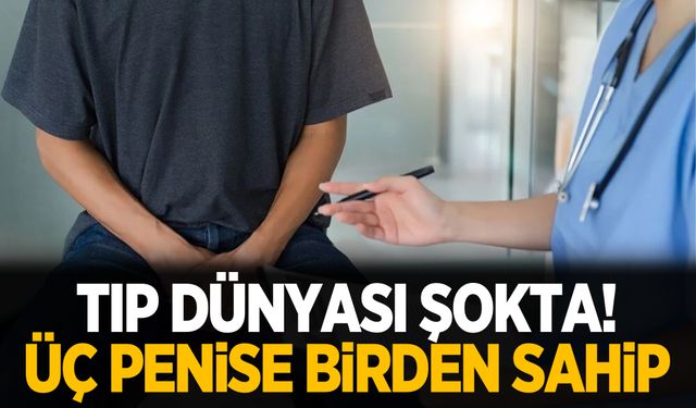 Doktorlar şokta! 78 yaşındaki adam üç penise sahip