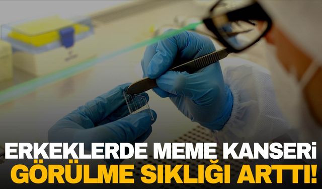 Erkekler dikkat! Meme kanseri görülme sıklığı artıyor