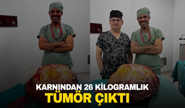 Karın ağrısıyla hastaneye gitti! Karnından 26 kilogramlık tümör çıktı