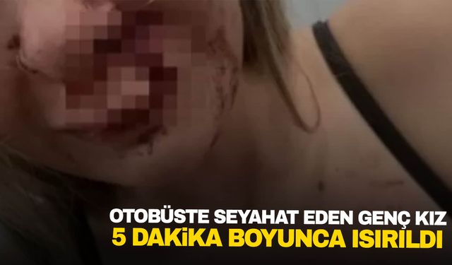 Otobüste seyahat eden genç kızın yüzünü ısırdı: 50 dikiş atıldı