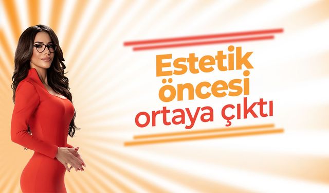 Ela Rümeysa Cebeci'nin eski hali gündem oldu: Estetikten önceki görüntüleri ortaya çıktı