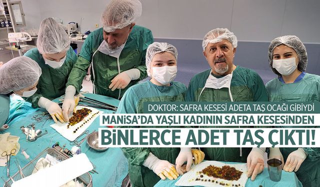 Manisa'da ameliyat olan bir kadından binlerce adet taş çıktı!