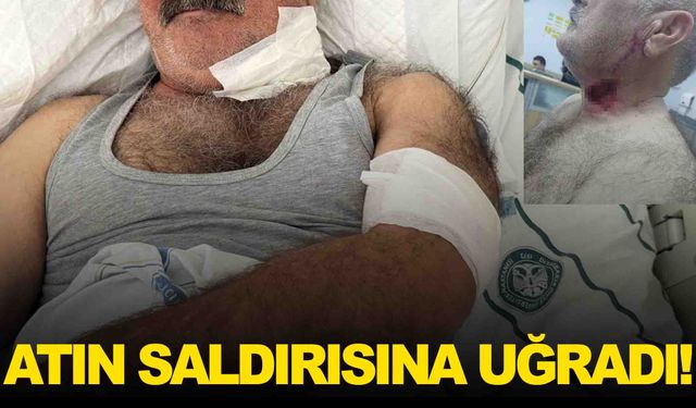 Korkunç olay... At, sahibini boğazından ısırdı!