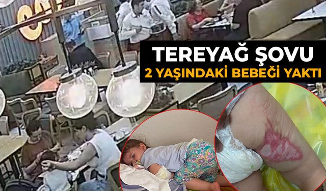 Tereyağı şovu 2 yaşındaki bebeği yaktı