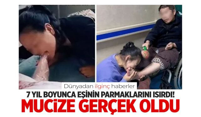 7 yıl boyunca eşinin parmaklarını ısırarak mucizeye neden oldu