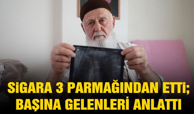 Sigara 3 parmağından etti!