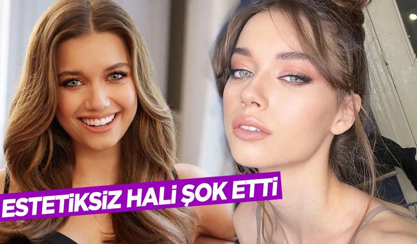 Yalı Çapkını’nın Seyran’ı Afra Saraçoğlu’nun estetiksiz hali ortaya çıktı!