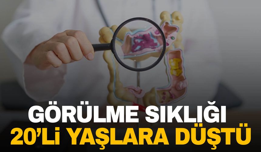 Kolon kanseri görülme sıklığı 20’li yaşlara kadar düştü