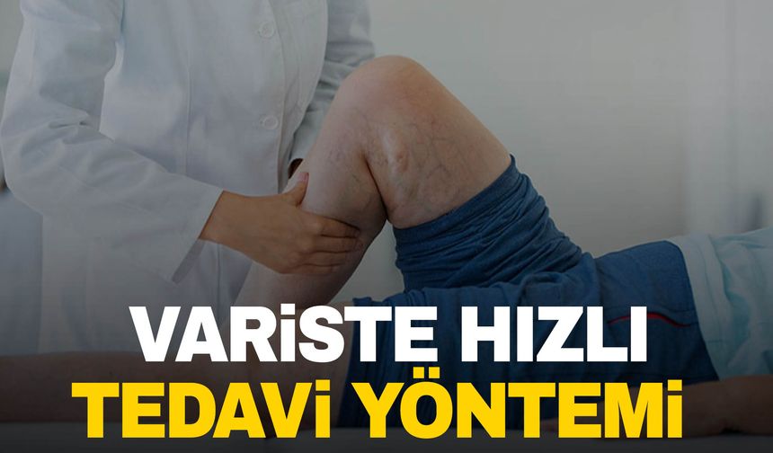 Uzmanı açıkladı! Variste hızlı tedavi yöntemi