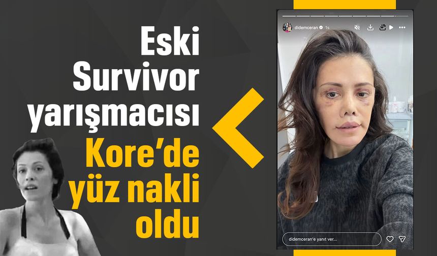 Eski Survivor yarışmacısı Güney Kore'de yüz nakli yaptırdı