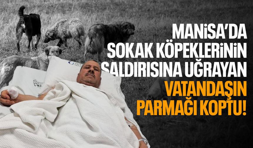 Manisa'da sokak köpeklerinin saldırısına uğrayan vatandaşın parmağı koptu
