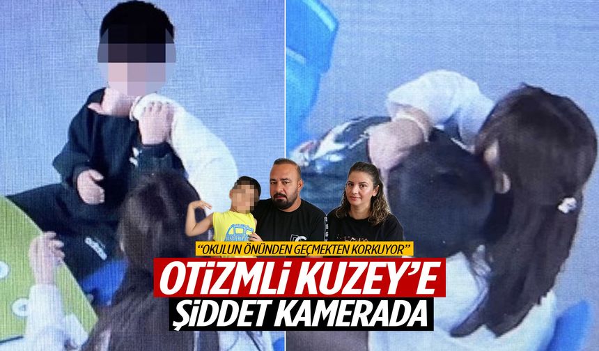 Otizmli Kuzey'e şiddet kamerada!