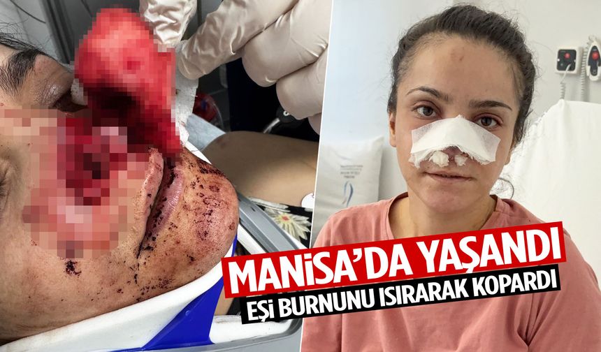 Manisa’da yaşandı… Eşi burnunu ısırarak kopardı!