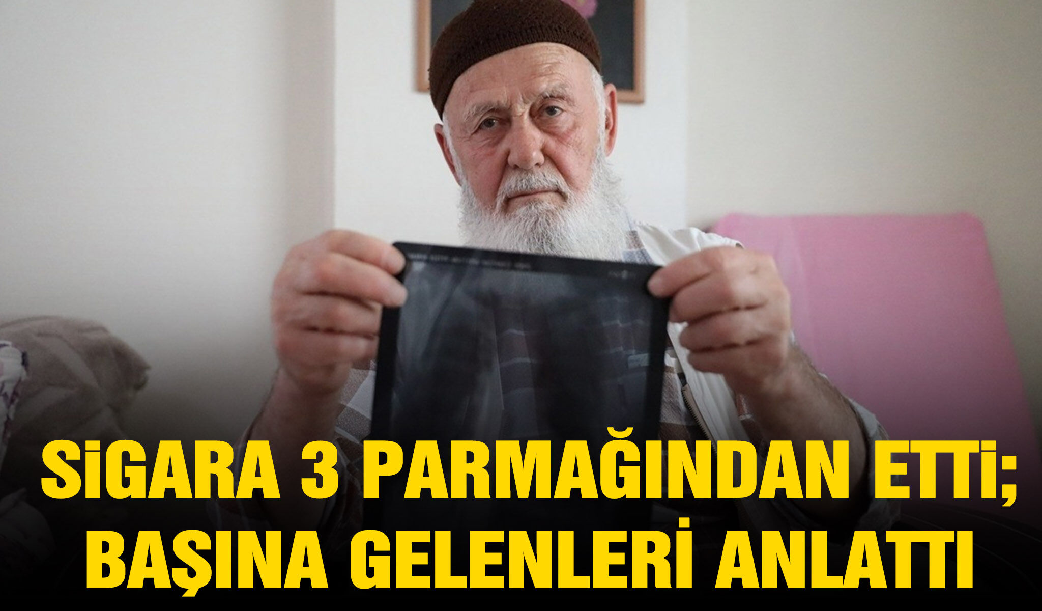 Sigara 3 parmağından etti!