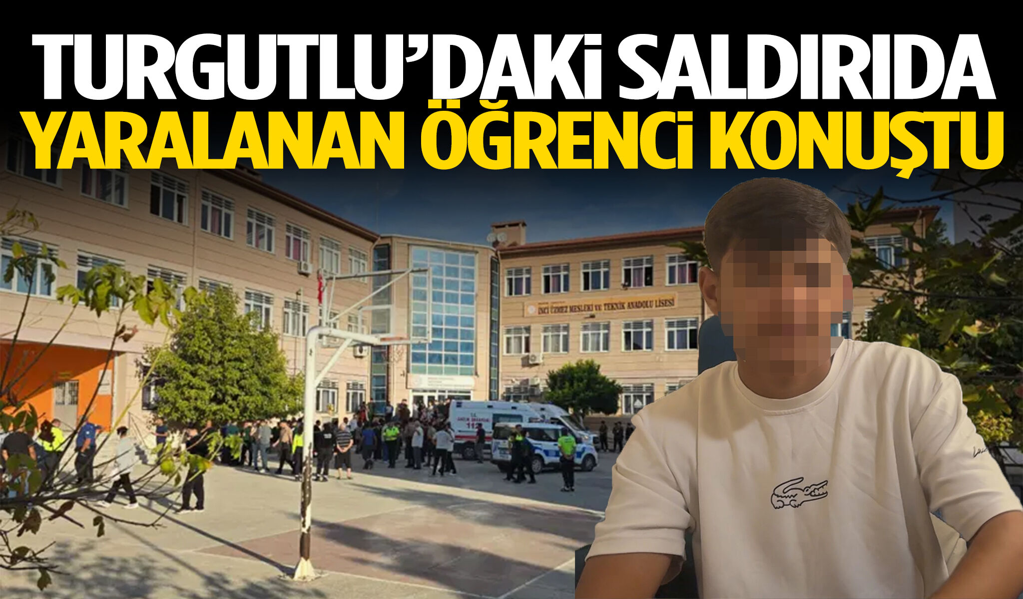Bacağında 35 saçmayla taburcu oldu! Turgutlu’daki saldırıyı anlattı